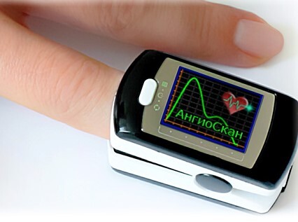 <blockquote>CHECK UP&nbsp;— АНГИОСКАНИРОВАНИЕ</blockquote>